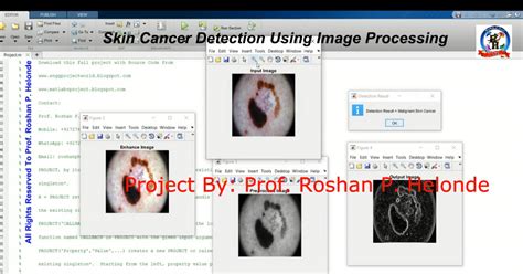 Skin Cancer Detection Matlab Code