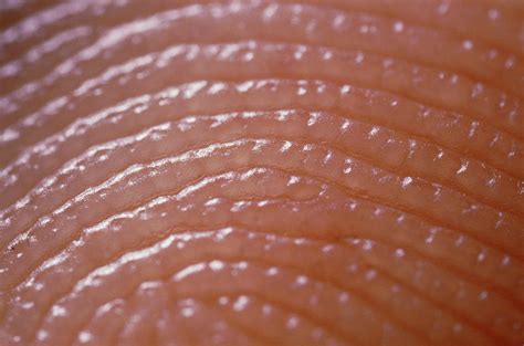 Skin Ridges