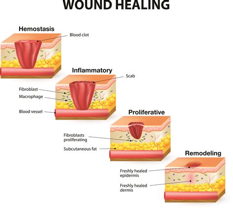 Download Skin Anatomy Physiology And Wound Healing Wounds Canada 