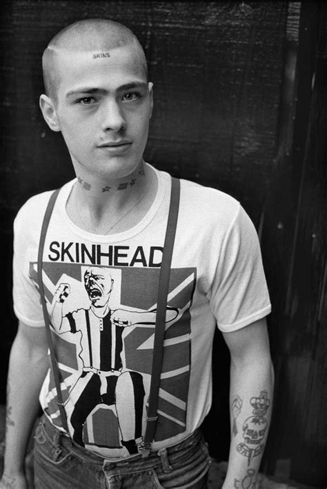 Skinhead