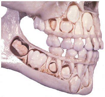 Skull Milk Teeth