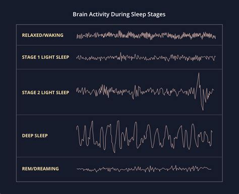 sleep and brain activity