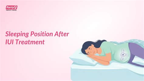Sleeping Position After Iui