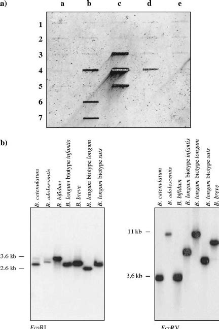 Slot Blot Hybridization Of Extracted Dna From The 46 Corneal Samples     - Analisa Slot