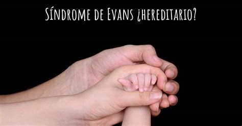Sme De Evans