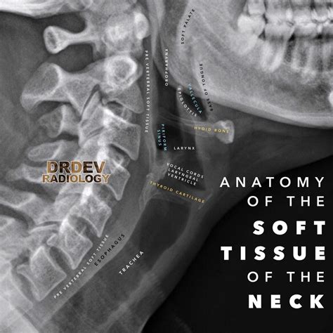 Soft Tissue Neck Xray