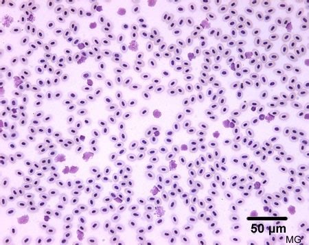 solunetti: Erytrosyytit eli punasolut