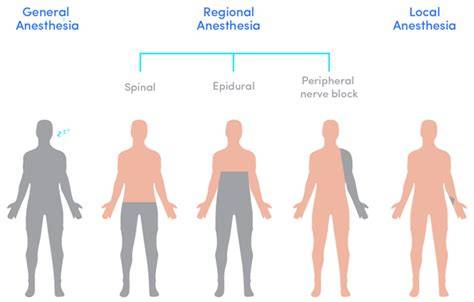 specific anesth orthopedi