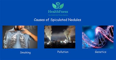 Full Download Spiculated Nodule Manual Guide 