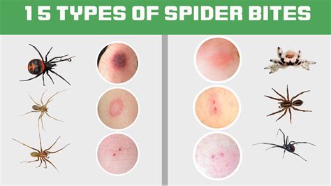 Spiders Bites Identification Chart