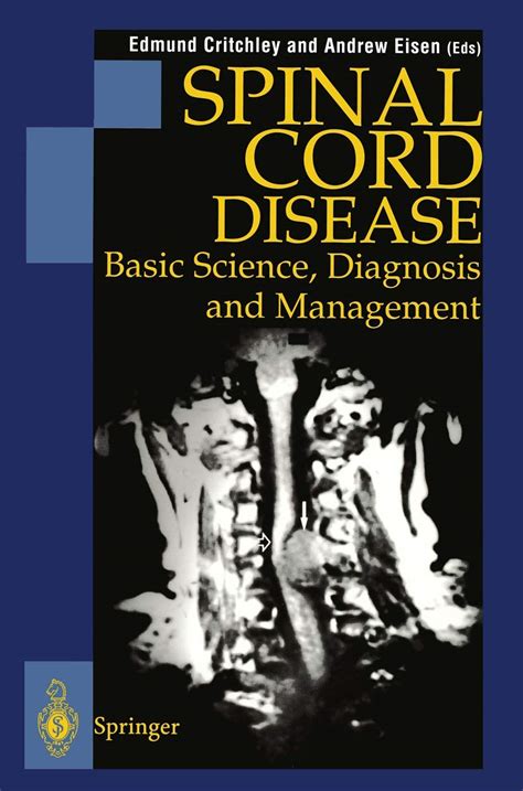 Spinal Cord Disease Basic Science Diagnosis And Management