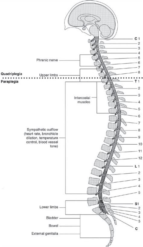 spinal cord injury - Medical Dictionary