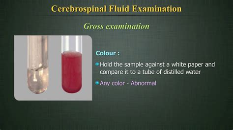 spinal fluid color