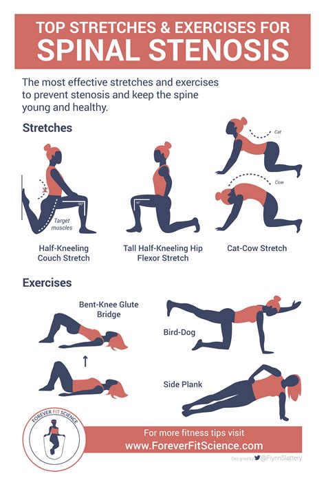 spinal stenosis exercises