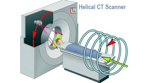 Spiral And Multislice Computed Tomography Of The Body Thieme