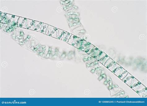 Spirogyra Under Microscope