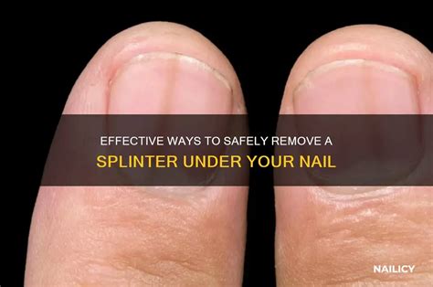 Splinter Under Nail Infection