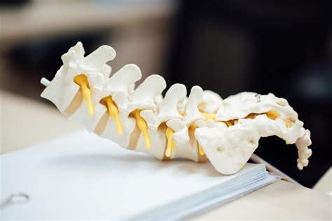 spondylos behandling