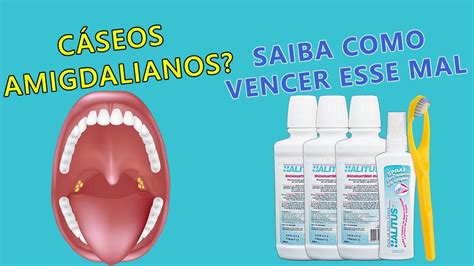 Spray Para Caseum