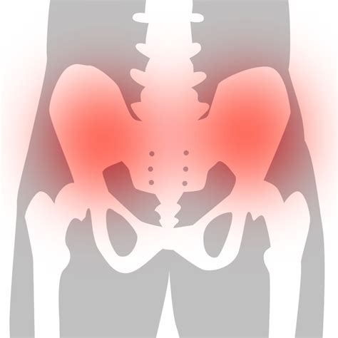 spricka i bäcken efter fall