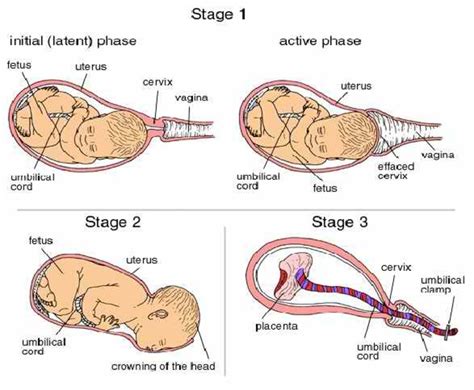 Stages Of Labour Ppt