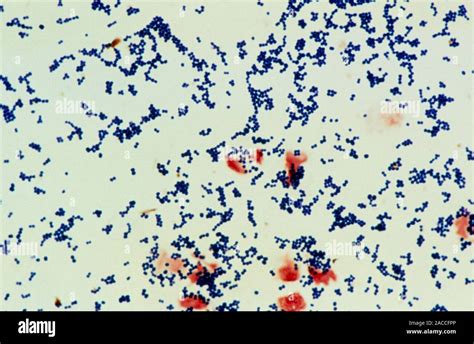 Staph Albus Bacteria