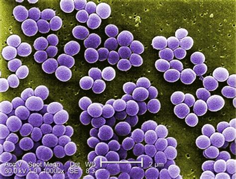 staphylococcus aureus | Isolation and phylogenetic analysis of Staphylococcus aureus