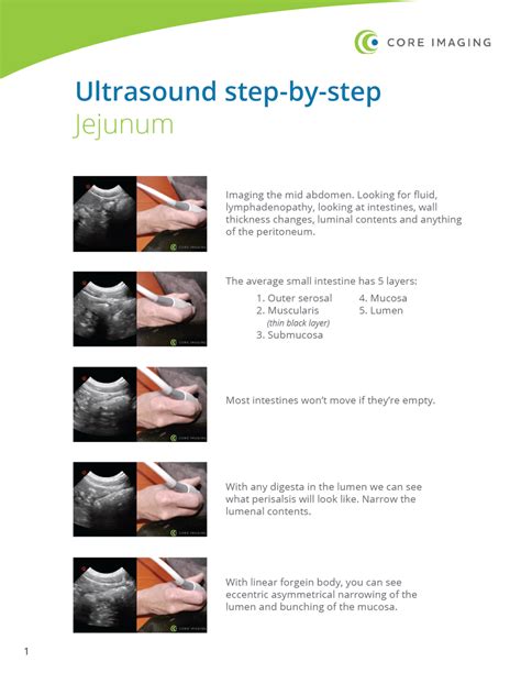 Read Step By Step Ultrasound 