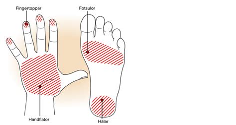 sticker under fötterna