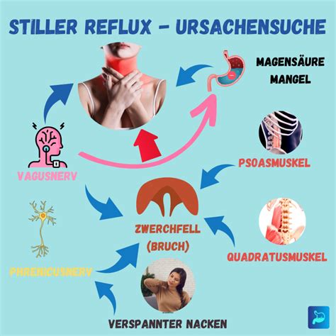 Stiller Reflux