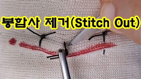 stitch out 시기