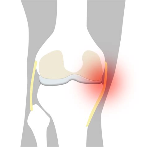 strackning insida kna