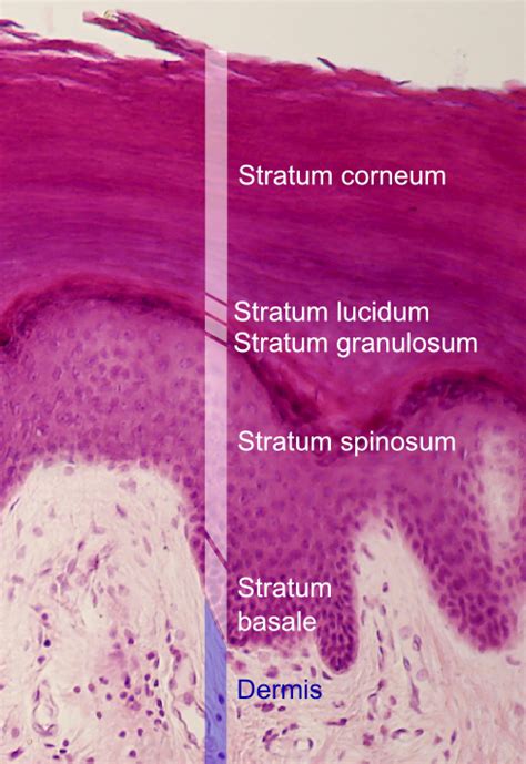 stratum spinosum adalah