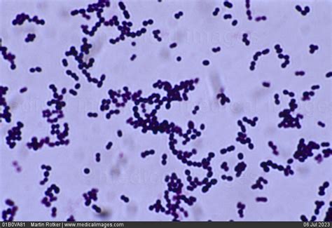 streptococcus beta hemolyticus