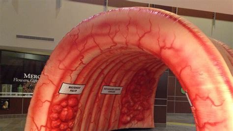 strollin in the colon