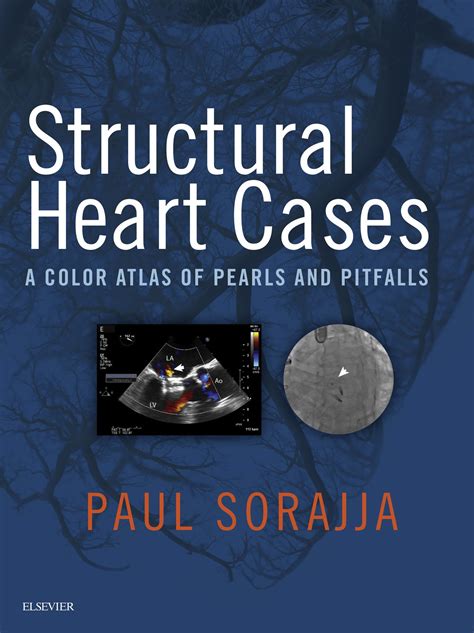 Structural Heart Cases A Color Atlas Of Pearls And