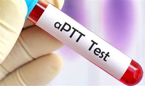 Read Online Study Guide For Apttp Test 