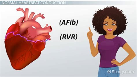 Read Study Guide Rvr 