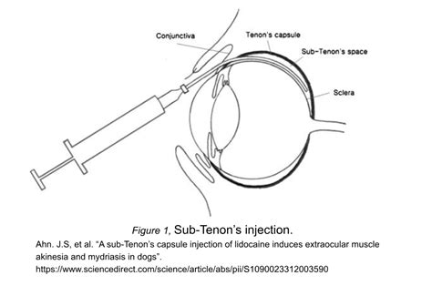 Sub Tenon Space