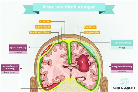 subaraknoidalblödning likvor