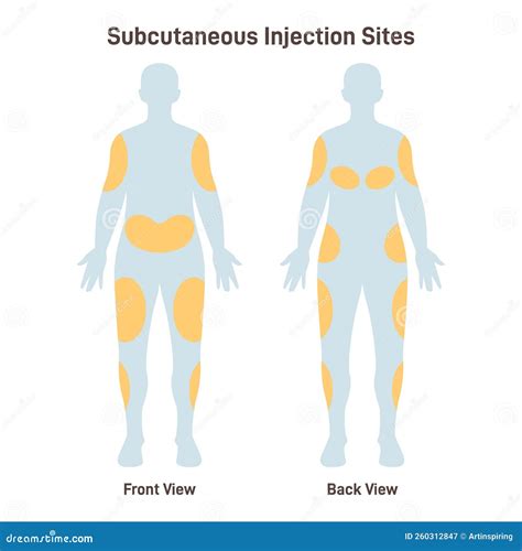 Subcutaneous Injection Sites