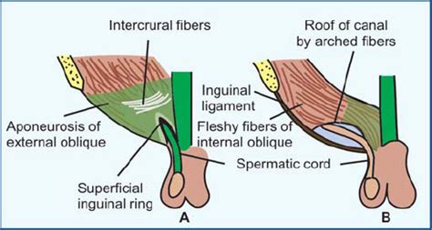 Superficial Inguinal Ring