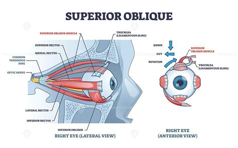 Superior Oblique