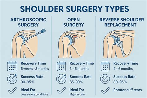 Surgery Of The Shoulder Data Handling In Science And Technology