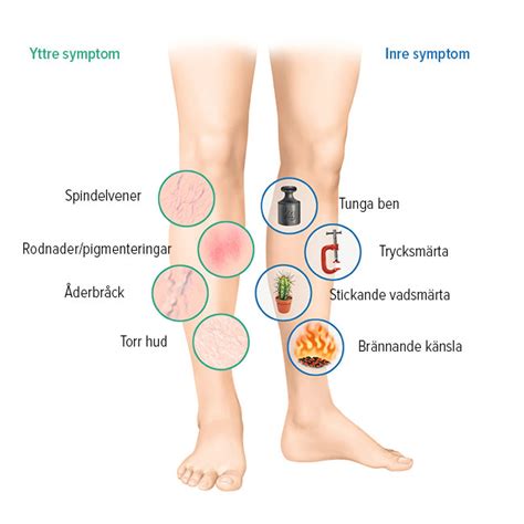 svullna anklar gravid