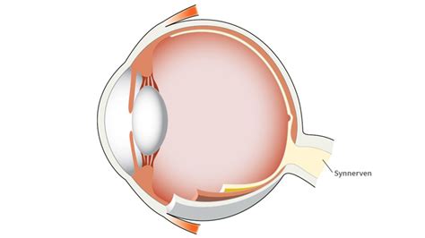 synnervsinflammation behandling