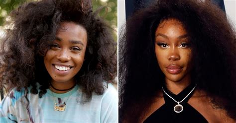 Sza Before Surgey