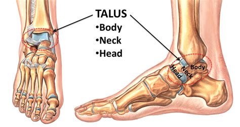 talus foot problems