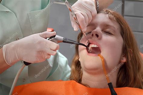tand polijsten procedure