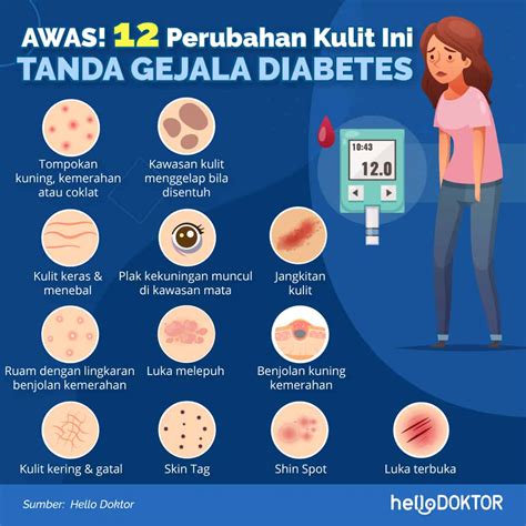 Ciri-Ciri Diabetes pada Wanita: Gejala, Risiko, dan Penanganan -